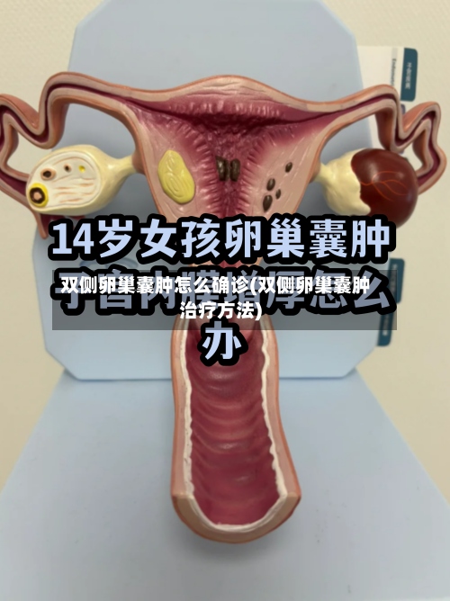 双侧卵巢囊肿怎么确诊(双侧卵巢囊肿治疗方法)