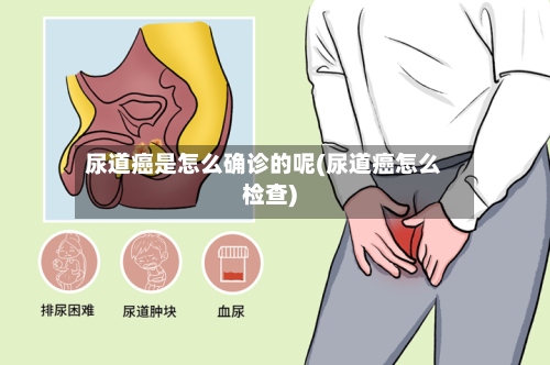 尿道癌是怎么确诊的呢(尿道癌怎么检查)-第2张图片