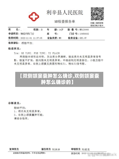 【双侧颌窦囊肿怎么确诊,双侧颌窦囊肿怎么确诊的】-第2张图片