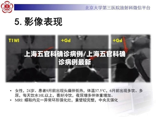 上海五官科确诊病例/上海五官科确诊病例最新