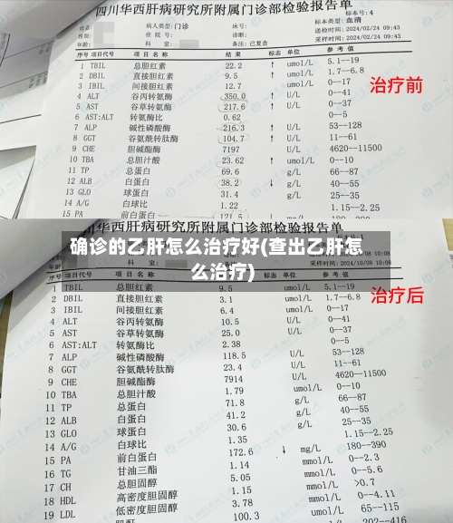 确诊的乙肝怎么治疗好(查出乙肝怎么治疗)-第3张图片