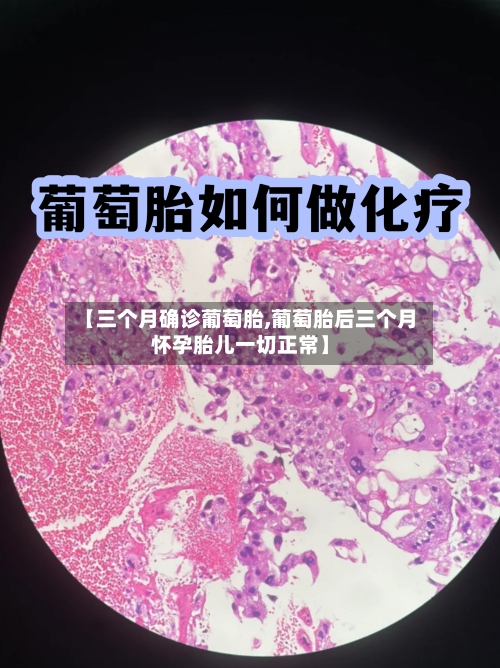 【三个月确诊葡萄胎,葡萄胎后三个月怀孕胎儿一切正常】-第2张图片