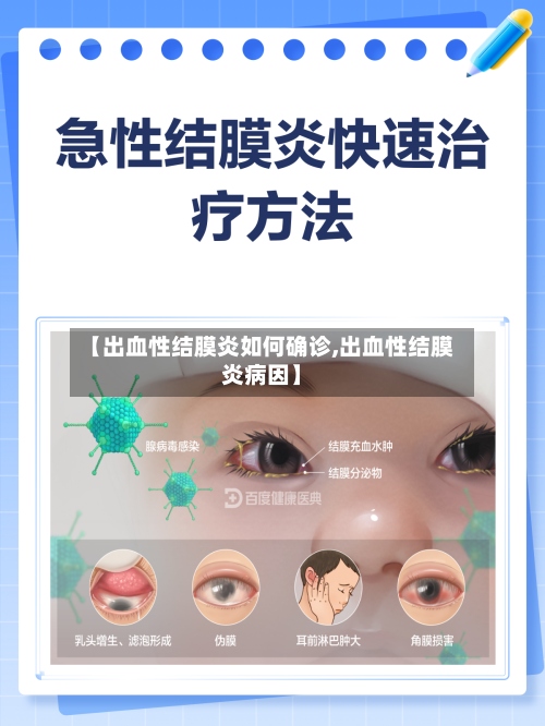 【出血性结膜炎如何确诊,出血性结膜炎病因】-第2张图片