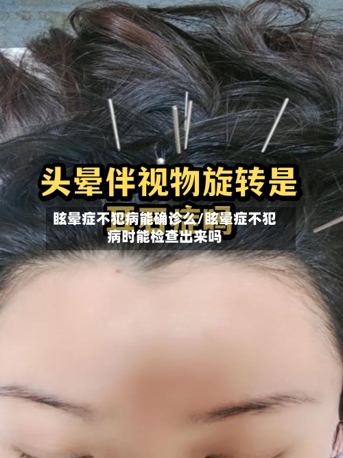 眩晕症不犯病能确诊么/眩晕症不犯病时能检查出来吗