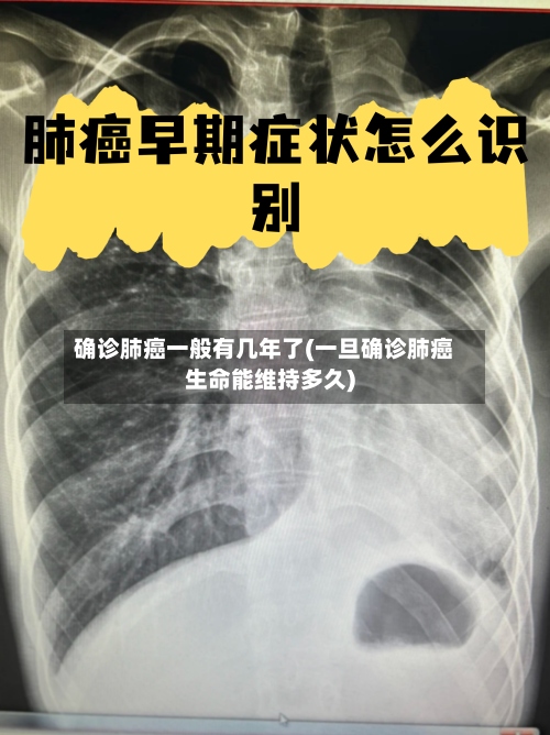 确诊肺癌一般有几年了(一旦确诊肺癌生命能维持多久)