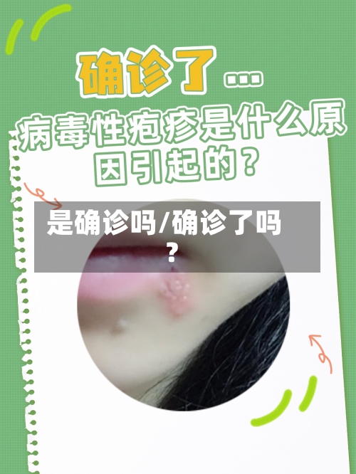 是确诊吗/确诊了吗?