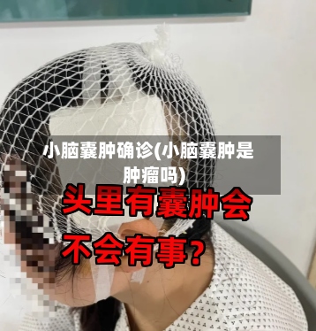 小脑囊肿确诊(小脑囊肿是肿瘤吗)