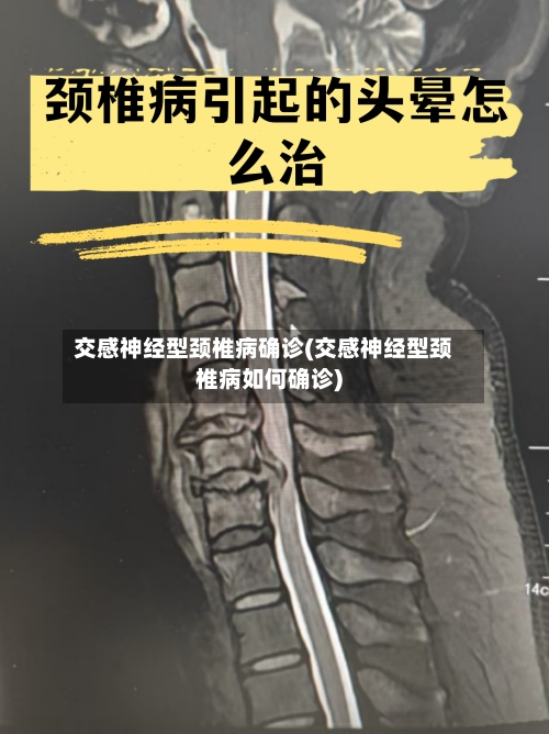 交感神经型颈椎病确诊(交感神经型颈椎病如何确诊)-第2张图片