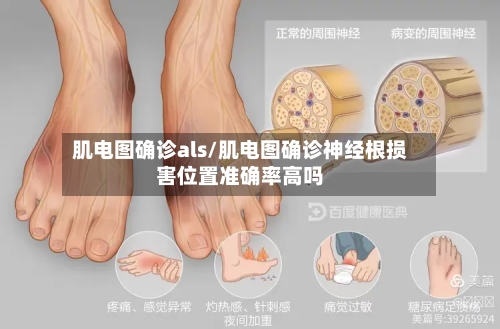 肌电图确诊als/肌电图确诊神经根损害位置准确率高吗-第2张图片