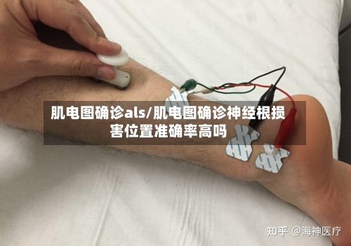 肌电图确诊als/肌电图确诊神经根损害位置准确率高吗