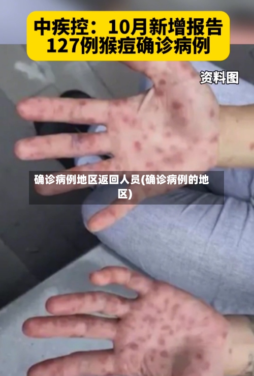 确诊病例地区返回人员(确诊病例的地区)