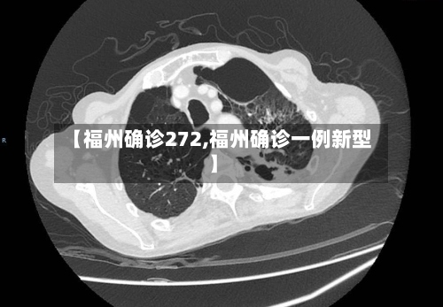 【福州确诊272,福州确诊一例新型】