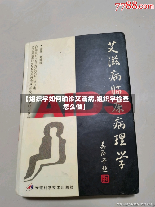 【组织学如何确诊艾滋病,组织学检查怎么做】