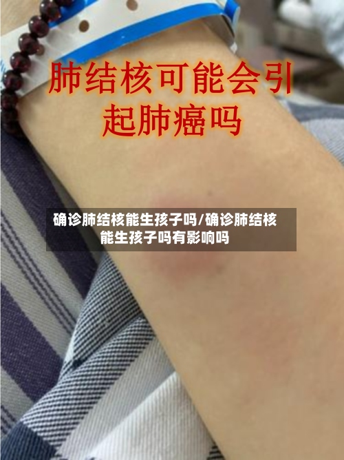 确诊肺结核能生孩子吗/确诊肺结核能生孩子吗有影响吗-第2张图片