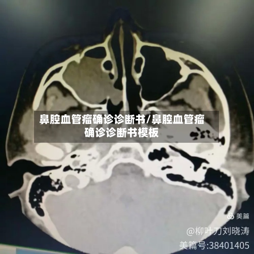 鼻腔血管瘤确诊诊断书/鼻腔血管瘤确诊诊断书模板-第3张图片