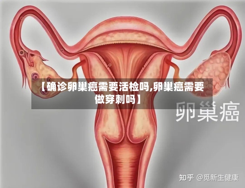 【确诊卵巢癌需要活检吗,卵巢癌需要做穿刺吗】