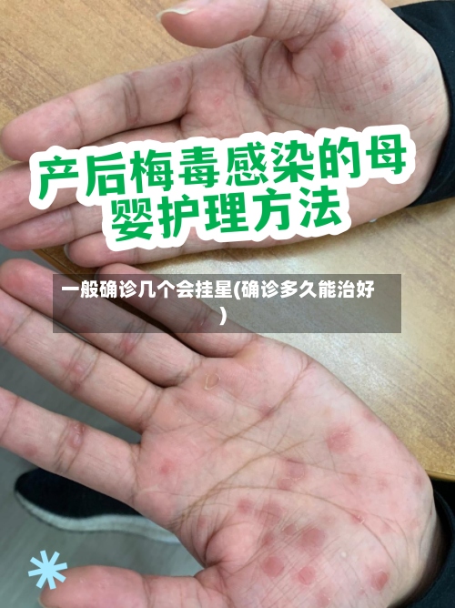 一般确诊几个会挂星(确诊多久能治好)-第2张图片