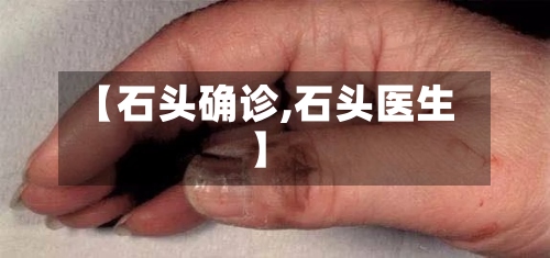 【石头确诊,石头医生】-第2张图片