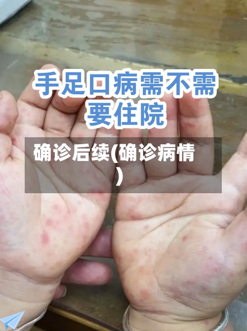 确诊后续(确诊病情)-第2张图片