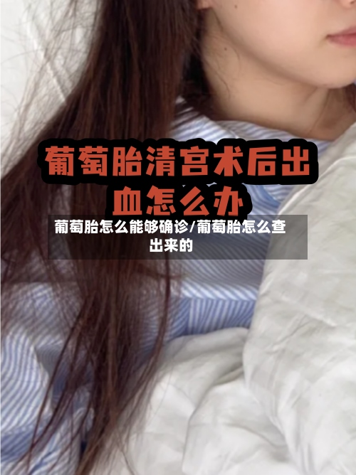 葡萄胎怎么能够确诊/葡萄胎怎么查出来的