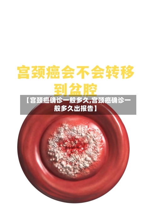 【宫颈癌确诊一般多久,宫颈癌确诊一般多久出报告】