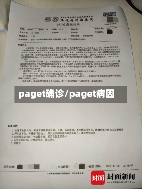 paget确诊/paget病因