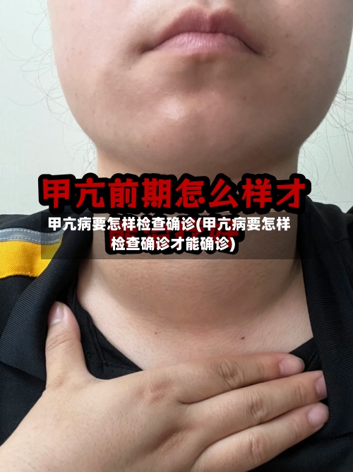 甲亢病要怎样检查确诊(甲亢病要怎样检查确诊才能确诊)-第3张图片