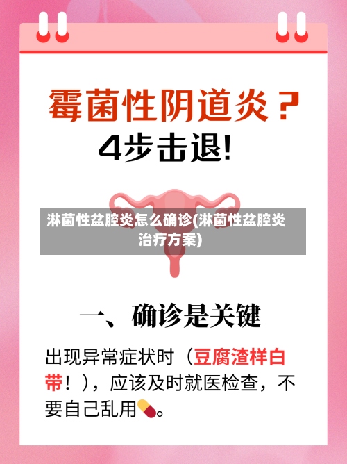 淋菌性盆腔炎怎么确诊(淋菌性盆腔炎治疗方案)