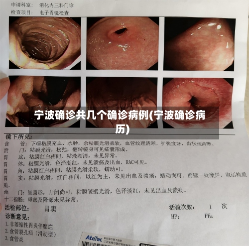 宁波确诊共几个确诊病例(宁波确诊病历)