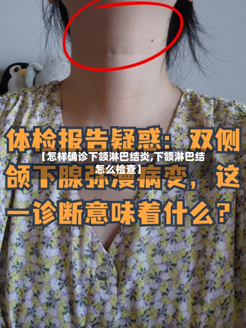 【怎样确诊下颌淋巴结炎,下颌淋巴结怎么检查】-第3张图片