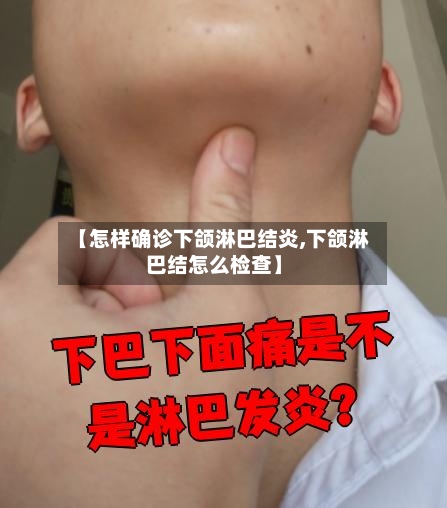 【怎样确诊下颌淋巴结炎,下颌淋巴结怎么检查】-第2张图片