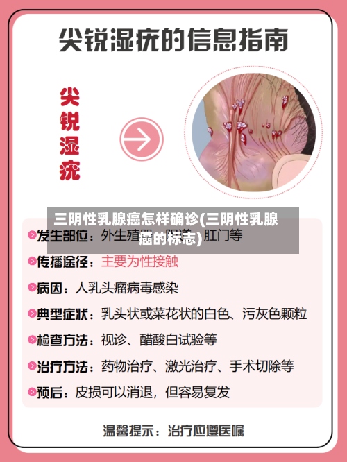 三阴性乳腺癌怎样确诊(三阴性乳腺癌的标志)