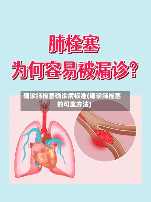 确诊肺栓塞确诊病标准(确诊肺栓塞的可靠方法)-第3张图片