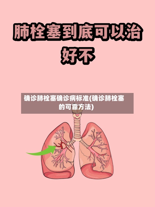 确诊肺栓塞确诊病标准(确诊肺栓塞的可靠方法)-第2张图片
