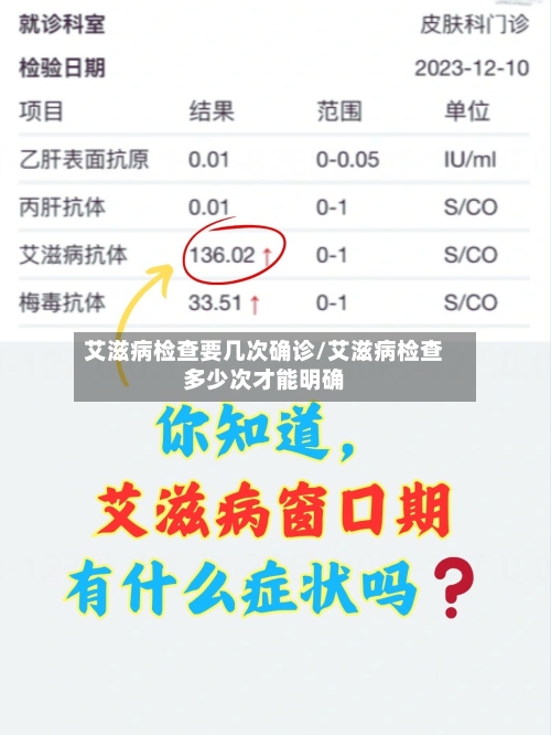 艾滋病检查要几次确诊/艾滋病检查多少次才能明确-第3张图片