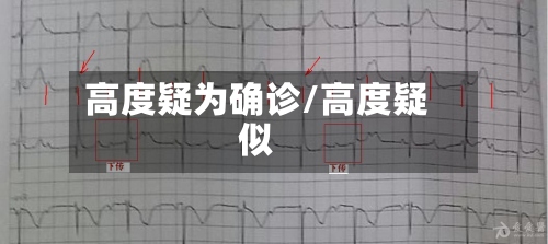 高度疑为确诊/高度疑似