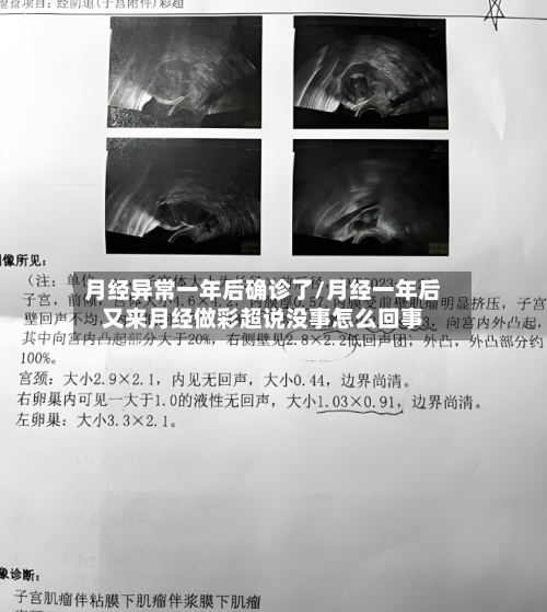 月经异常一年后确诊了/月经一年后又来月经做彩超说没事怎么回事
