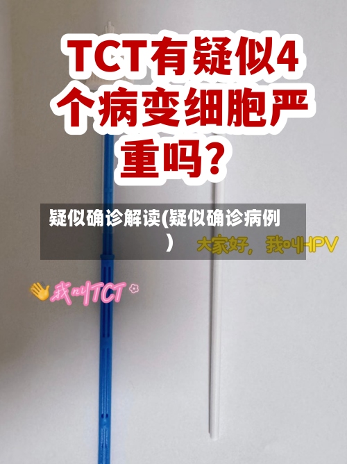 疑似确诊解读(疑似确诊病例)-第3张图片