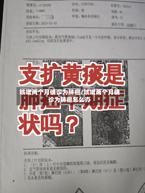 咳嗽两个月确诊为肺癌/咳嗽两个月确诊为肺癌怎么办