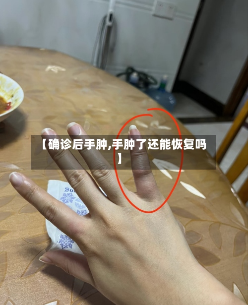 【确诊后手肿,手肿了还能恢复吗】