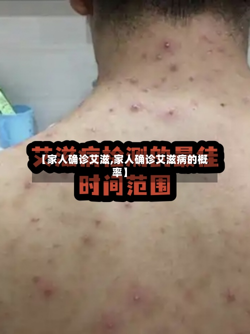 【家人确诊艾滋,家人确诊艾滋病的概率】-第2张图片