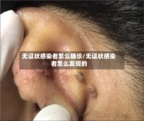 无证状感染者怎么确诊/无证状感染者怎么发现的-第3张图片