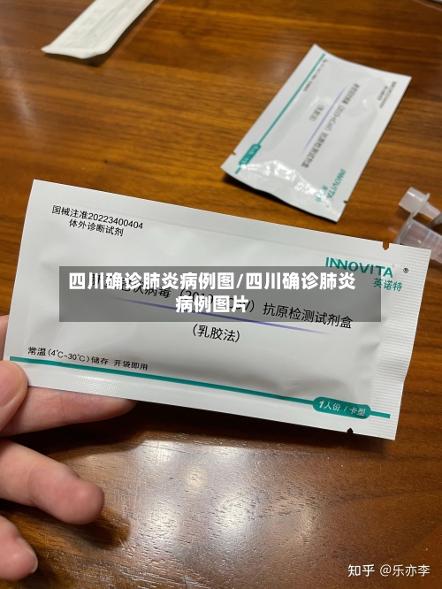 四川确诊肺炎病例图/四川确诊肺炎病例图片