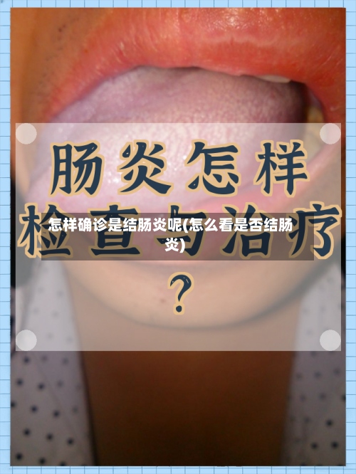 怎样确诊是结肠炎呢(怎么看是否结肠炎)-第2张图片