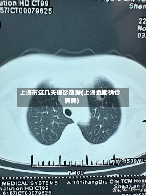 上海市这几天确诊数据(上海近期确诊病例)