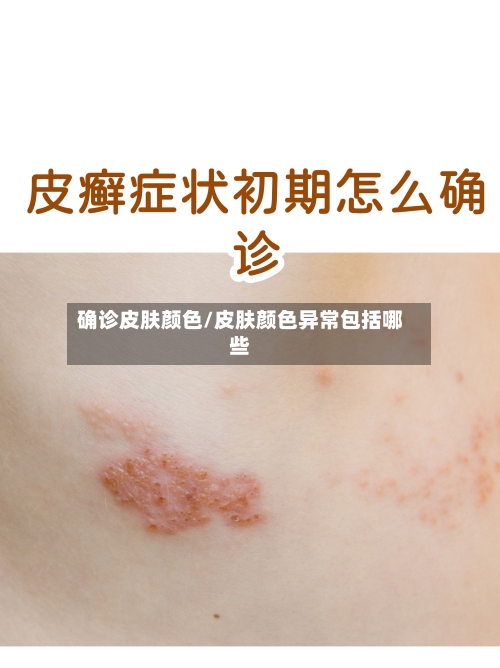 确诊皮肤颜色/皮肤颜色异常包括哪些