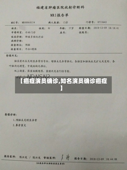 【癌症演员确诊,知名演员确诊癌症】