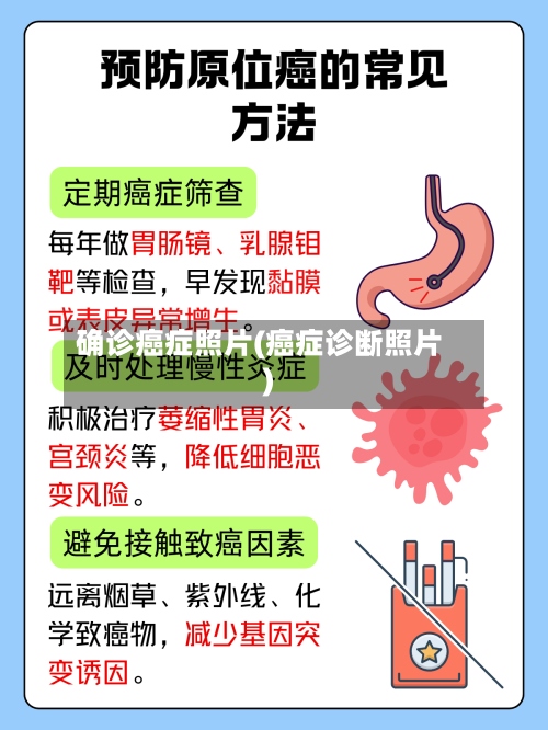 确诊癌症照片(癌症诊断照片)