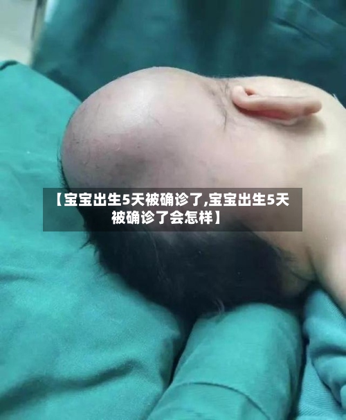 【宝宝出生5天被确诊了,宝宝出生5天被确诊了会怎样】