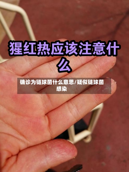 确诊为链球菌什么意思/疑似链球菌感染-第3张图片